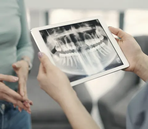 Mãos segurando um tablet com radiografia panorâmica durante uma conversa (imagem ilustrativa).